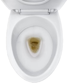 Dirty Toilets